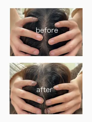 Bellferna所属・セラピスト杉山🌿 日暮里店のエステ・リラクイメージ