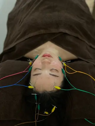 💙美容鍼💙美顔矯 正🧡Brilo🧡のエステ・リラクイメージ