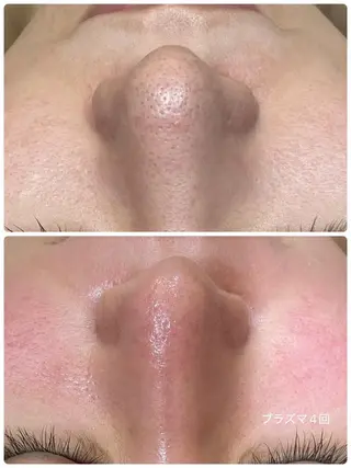 レイビス 渋谷店中野🤍のエステ・リラクイメージ