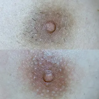 メンズ 佐々木 ちゆきのエステ・リラクイメージ