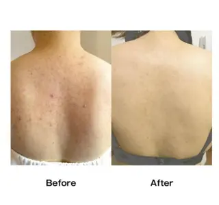 Tipani beaute'のエステ・リラクイメージ