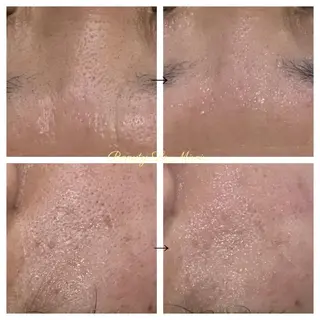 ビューティー ミロワールのエステ・リラクイメージ