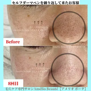 毛穴ケア専門サロン アメリオボーテのその他イメージ
