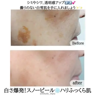 肌質管理専門店 Lé pia　AMIのエステ・リラクイメージ