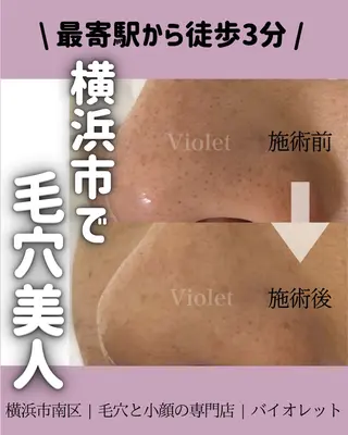 毛穴と耳つぼ専門店 バイオレット　りののその他イメージ