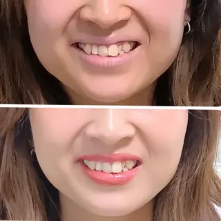 🎼グラデーション スタイル札幌♫*⁠✧のマツエク・マツパデザイン