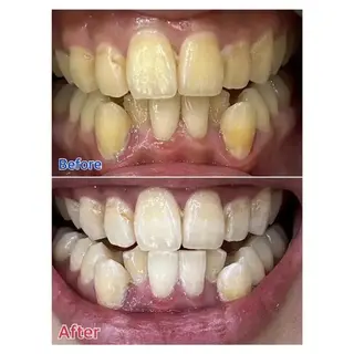 Ｍ渋谷 ホワイトニングのエステ・リラクイメージ