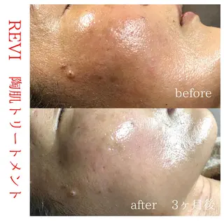 身体の土台作り necorobiのエステ・リラクイメージ