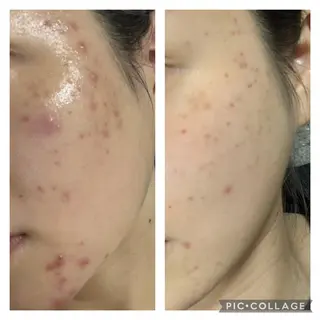 tominaga ryokoのヘアスタイル