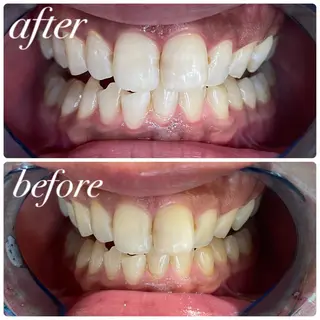 LIBRA心斎橋 セルフホワイトニングのその他イメージ