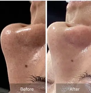 Dahlia Hondaのエステ・リラクイメージ