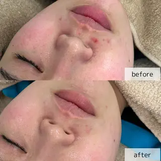 エステサロン Venusのその他イメージ