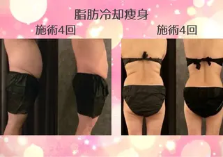マツエク・マツパ 愛維美水光美肌専門店 メンズレディースokのエステ・リラクイメージ
