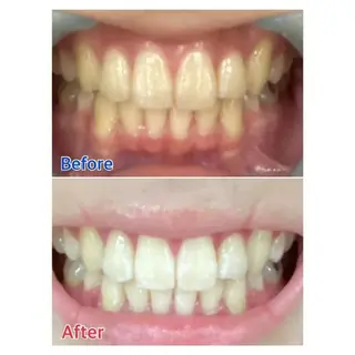 Ｍ渋谷 ホワイトニングのエステ・リラクイメージ