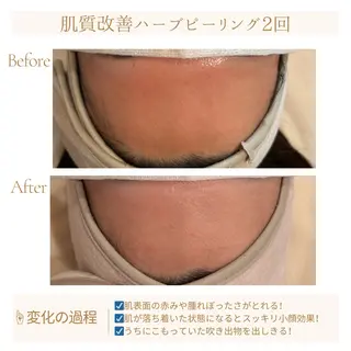 小顔×肌質改善サロン soin〔ソワン〕のエステ・リラクイメージ