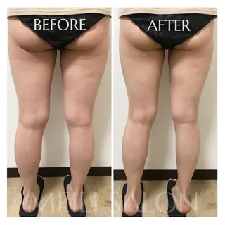 meili salonのエステ・リラクイメージ