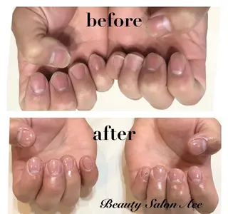 ネイル 池袋フィルイン Ace♡Nailのネイルデザイン