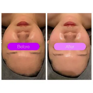 小顔コルギ ☆表参道/外苑前のエステ・リラクイメージ