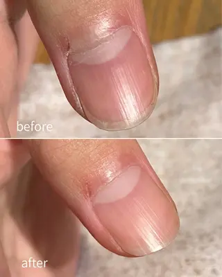 ネイル VERMA 育爪・ケア専門のネイルデザイン