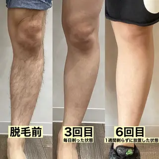 セルフメイド サンリブしみず店のエステ・リラクイメージ