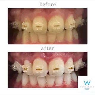 メンズ キッズ ホワイトニング ショップ町田店のその他イメージ