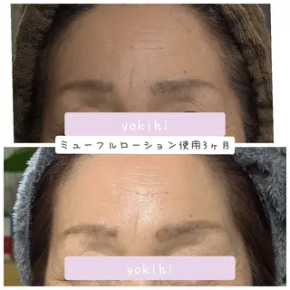 結果が出るスキンケア 肌質改善/まつパのエステ・リラクイメージ