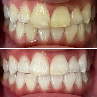 ショート カラー メンズ ネイル ホワイトニングサロン CREWのその他イメージ