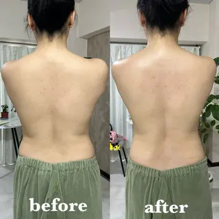 肌質改善＆脱毛 【M Mondo】のエステ・リラクイメージ