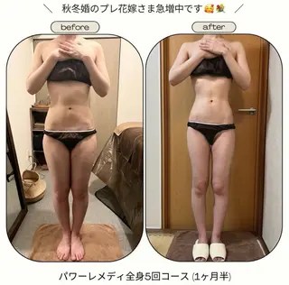 《本気痩せ×疲労改善 》  BILOOPのエステ・リラクイメージ