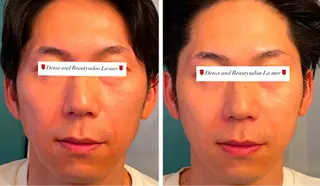 耳ツボ/体質改善/ 温活La mer月島のその他イメージ