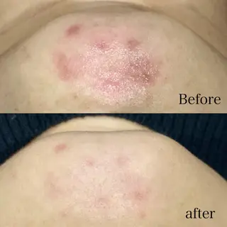 Dahlia痩身脱毛 フェイシャル 中村のエステ・リラクイメージ