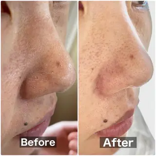 beauty salon  SUKOBI所属・ﾋﾞｭｰﾃｨｻﾛﾝ SUKOBIのエステ・リラクイメージ