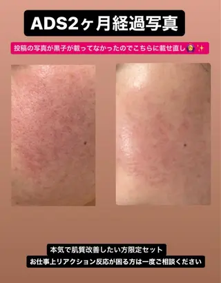 大分賀来リラクサロン M.EMINYのエステ・リラクイメージ