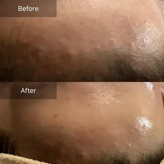 Mandarin Orange所属・毛穴から始める肌メン テマンダリンオレンジのエステ・リラクイメージ