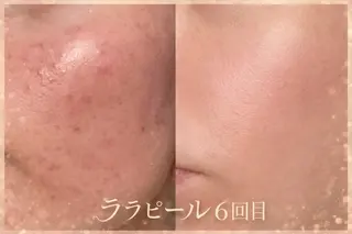 BIJOU八井 美加のエステ・リラクイメージ