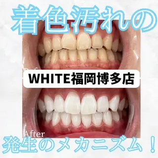 メンズ セルフホワイトニング WHITE福岡博多店のエステ・リラクイメージ