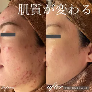 Ensor Clair所属・EnsorClair 代表　野口真央のエステ・リラクイメージ