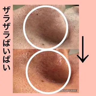 indiba soleilのエステ・リラクイメージ