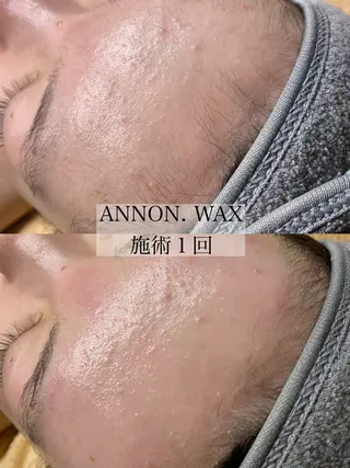 肌質改善ワックス専門 yukiのエステ・リラクイメージ