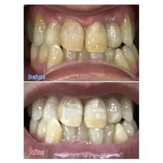 Ｍ渋谷 ホワイトニングのエステ・リラクイメージ