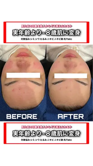 ロング カラー パーマ ヘアアレンジ メンズ キッズ ネイル マツエク・マツパ アイブロウ NANIOAFU [なんば店］のその他イメージ