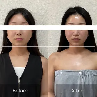 小顔×肌質改善 《お顔の印象》のエステ・リラクイメージ