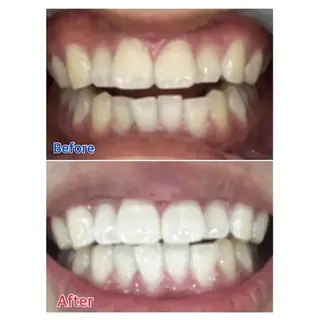 M渋谷 ホワイトニングのエステ・リラクイメージ