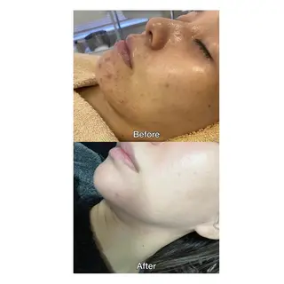 ROOM.S ｜脱毛｜美肌｜ボディのエステ・リラクイメージ