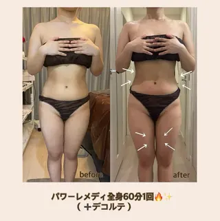 【痩身×リラク】 m.ﾐｰのエステ・リラクイメージ