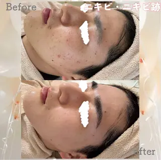 ニキビ&跡改善サロン オーナー光木のエステ・リラクイメージ