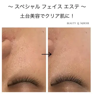 ビューティー ミロワールのエステ・リラクイメージ