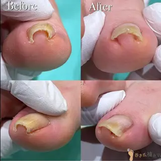 巻き爪アカデミー 溝の口のネイルデザイン