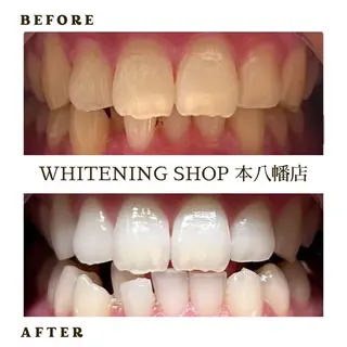 メンズ ホワイトニング ショップ本八幡店のエステ・リラクイメージ