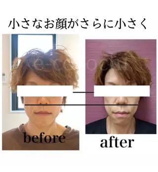 小顔と ヘッドスパのお店のエステ・リラクイメージ